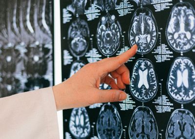 Neurodiversity